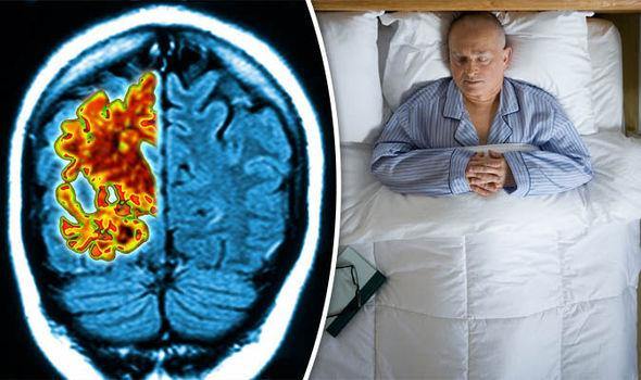 Dementia & Sleep Apnoea - Is there a link? - Inspira Nutritionals